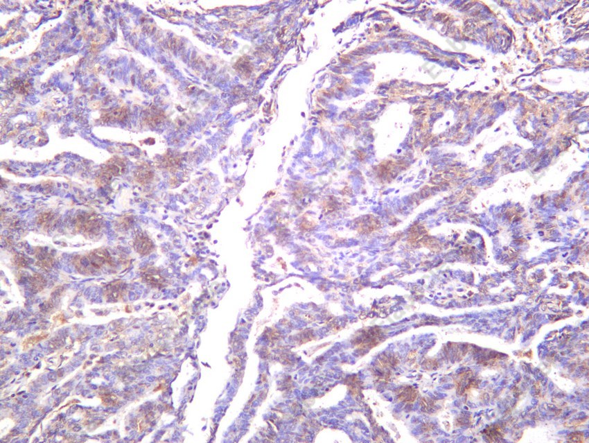Recombinant Phospho-mTOR (Ser2448) Monoclonal Antibody - 5