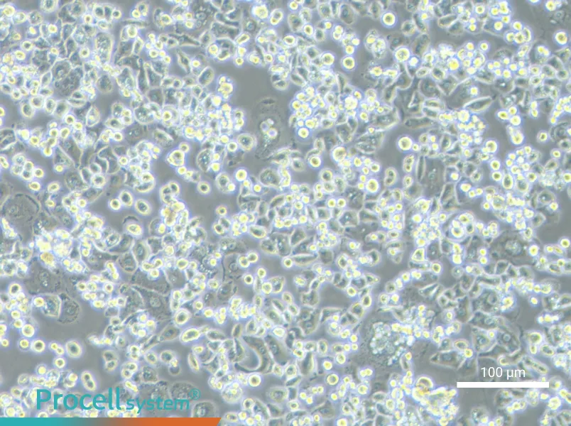 GCIY - 1