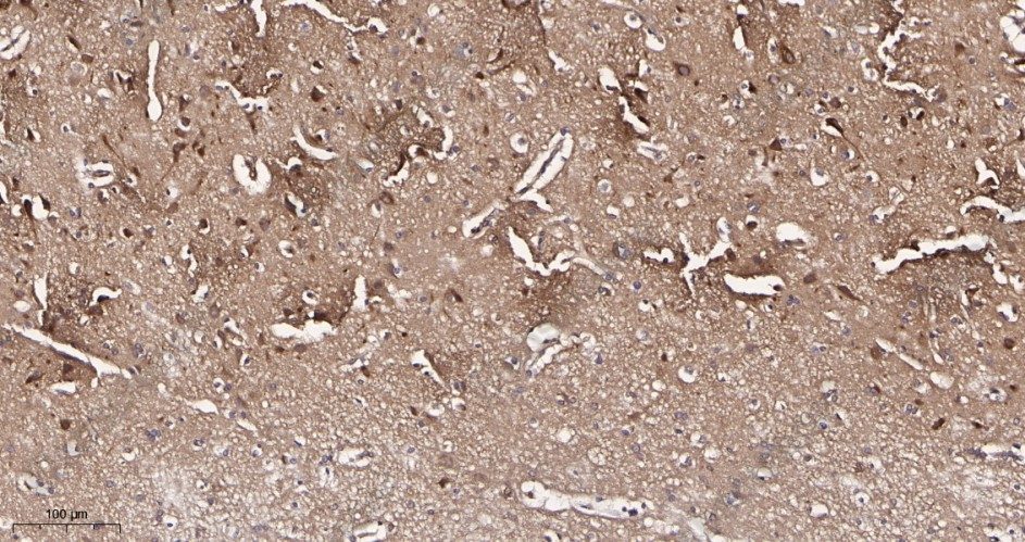Recombinant Optineurin Monoclonal Antibody - 2