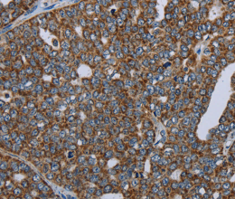 NDUFA13 Polyclonal Antibody - 2