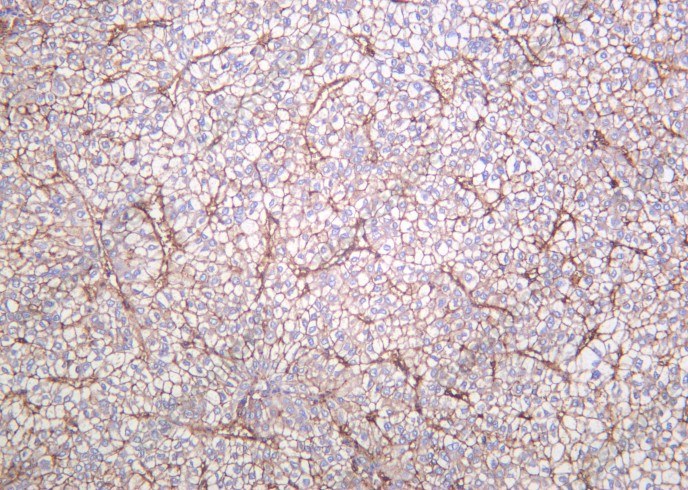 Recombinant Integrin β1 Monoclonal Antibody - 3