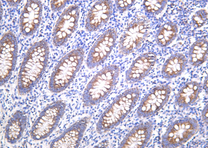 Recombinant BMP-4 Monoclonal Antibody-searchlist-1