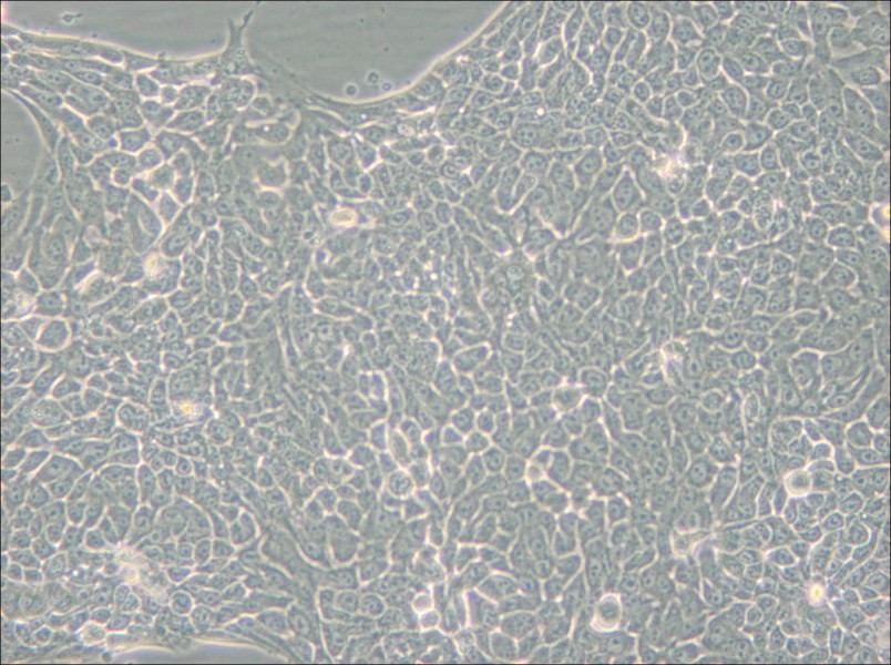 Detroit 562 Cell Complete Medium - 5