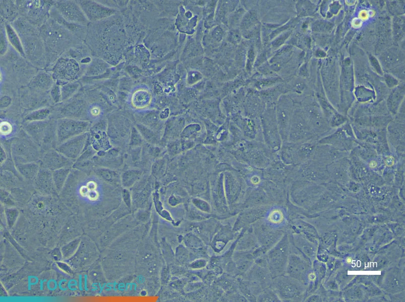 Rat Pulmonary Microvascular Endothelial Cell Complete Medium - 5