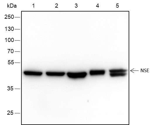 Recombinant NSE Monoclonal Antibody-searchlist-1