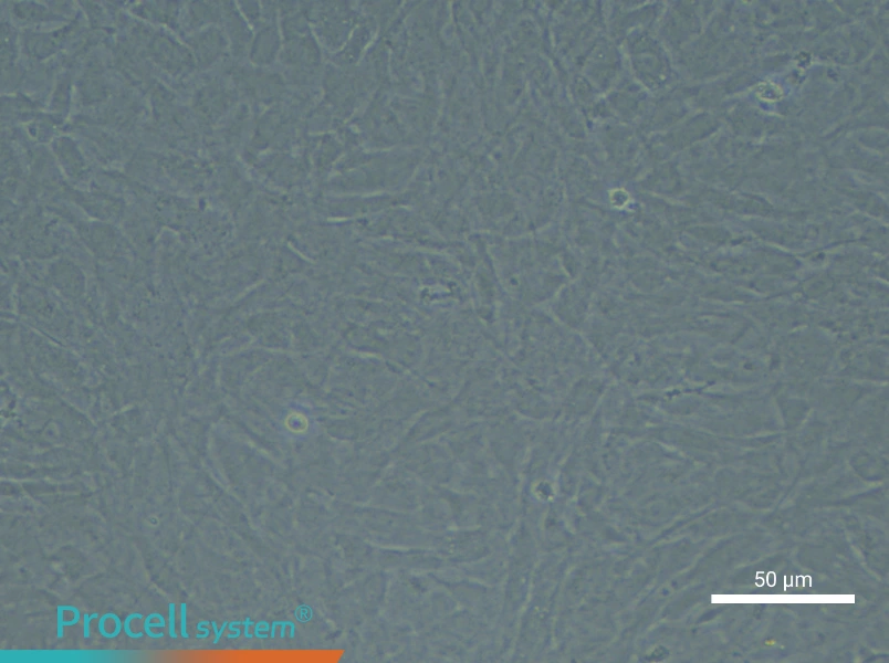 Rat Bronchial Fibroblast Complete Medium - 6
