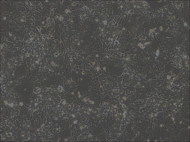 OE33 Cell Complete Medium - 3