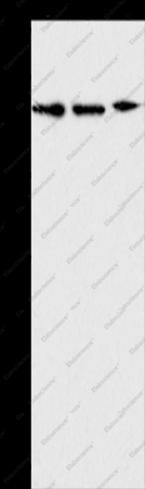 APOBEC3G Polyclonal Antibody - 1