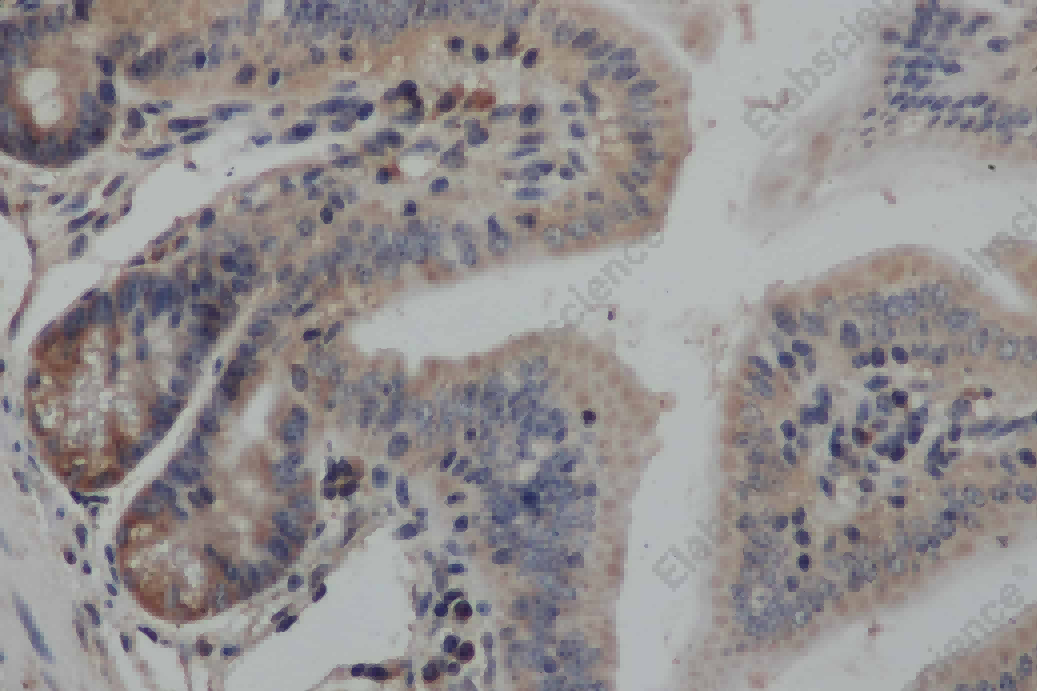 SMAD3 Polyclonal Antibody - 2