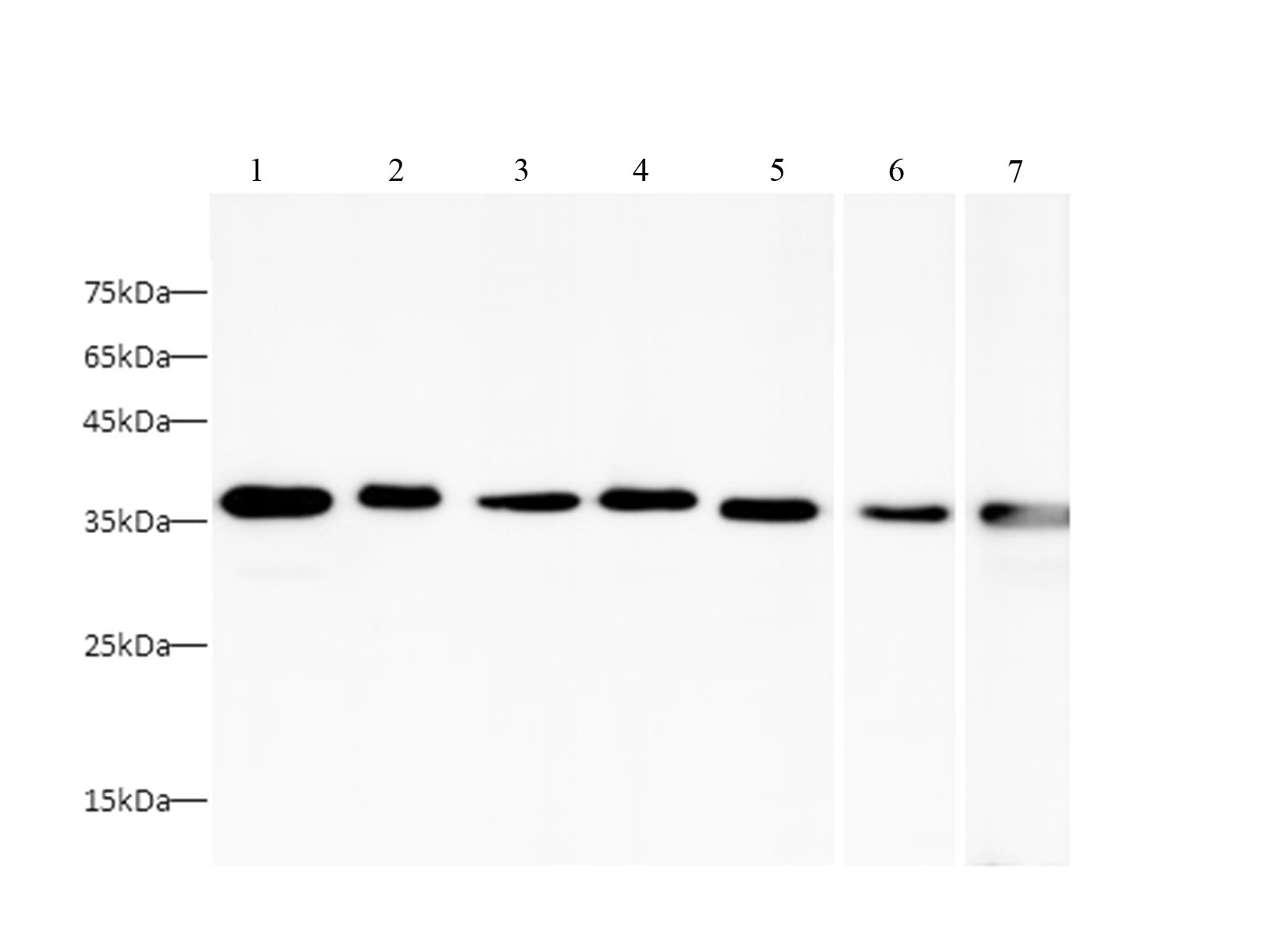 Purified Anti-Human IgD Antibody[IA6-2]-产品推荐-1