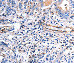 COX11 Polyclonal Antibody - 2