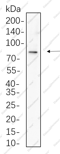 Recombinant Phospho-β Catenin (Ser675) Monoclonal Antibody - 1