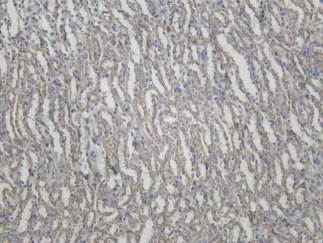 Recombinant Cathepsin B Monoclonal Antibody - 2