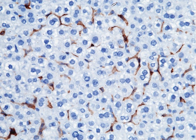 Recombinant CD16-2/FCGR4 Monoclonal Antibody - small - 3