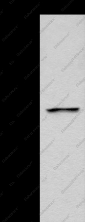 LOX Polyclonal Antibody - 1