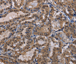 CUL3 Polyclonal Antibody - 2