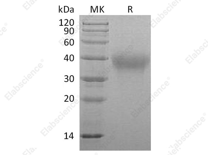 Recombinant Marmoset TIM-3/HAVCR2 Protein (His Tag) - 1
