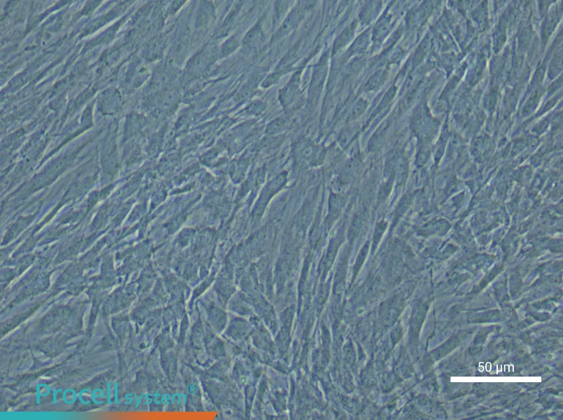 Human Uterine Smooth Muscle Cell Complete Medium - small - 4