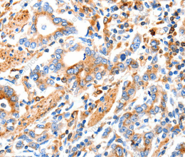 MAP2K2 Polyclonal Antibody - 2