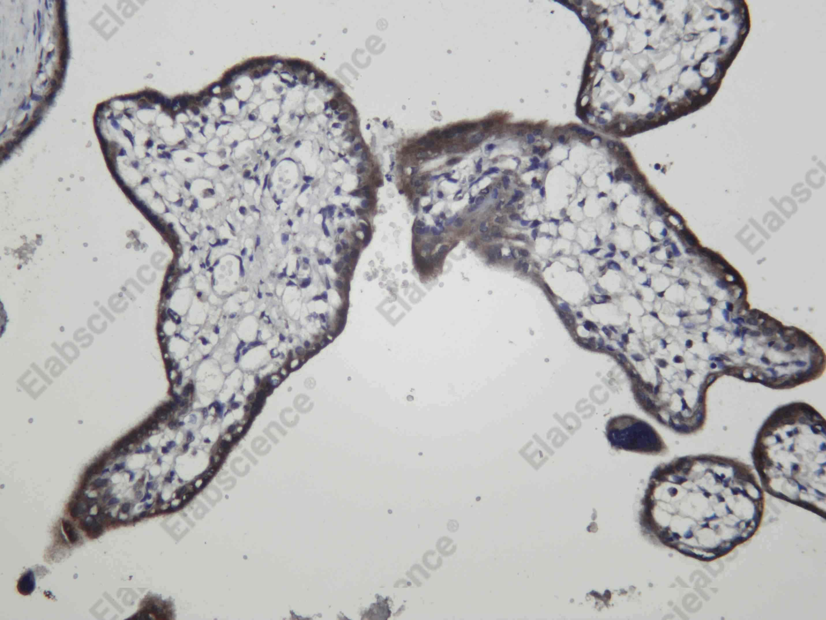 Recombinant MAGE 1 Monoclonal Antibody - 1