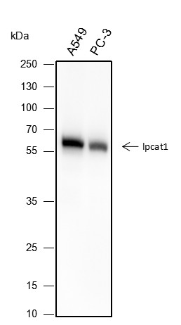 Recombinant LPCAT1 Monoclonal Antibody-searchlist-1
