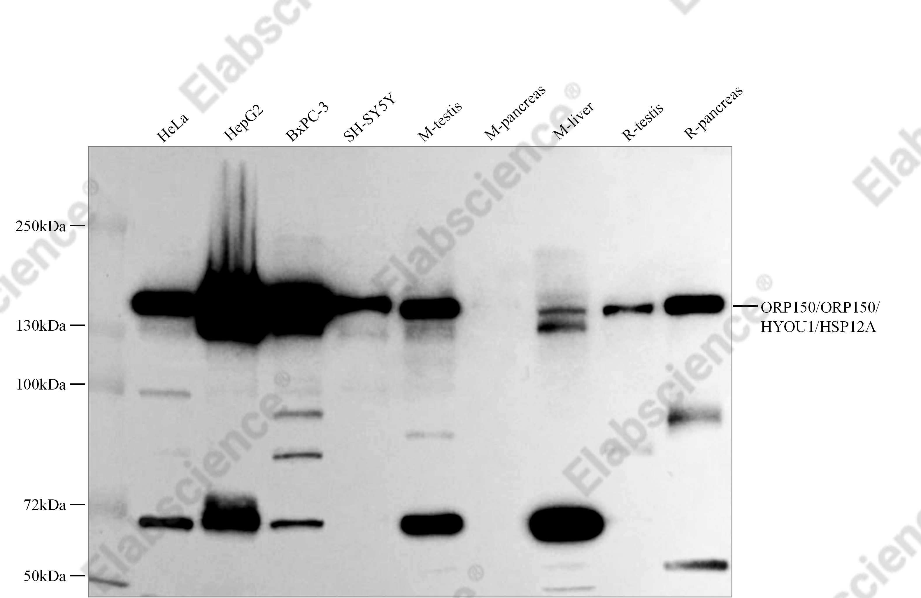 Recombinant ORP150/ORP150/HYOU1/HSP12A Monoclonal Antibody - 1