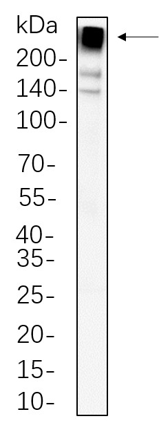 Recombinant Acetyl Coenzyme A Carboxylase beta Monoclonal Antibody-searchlist-1