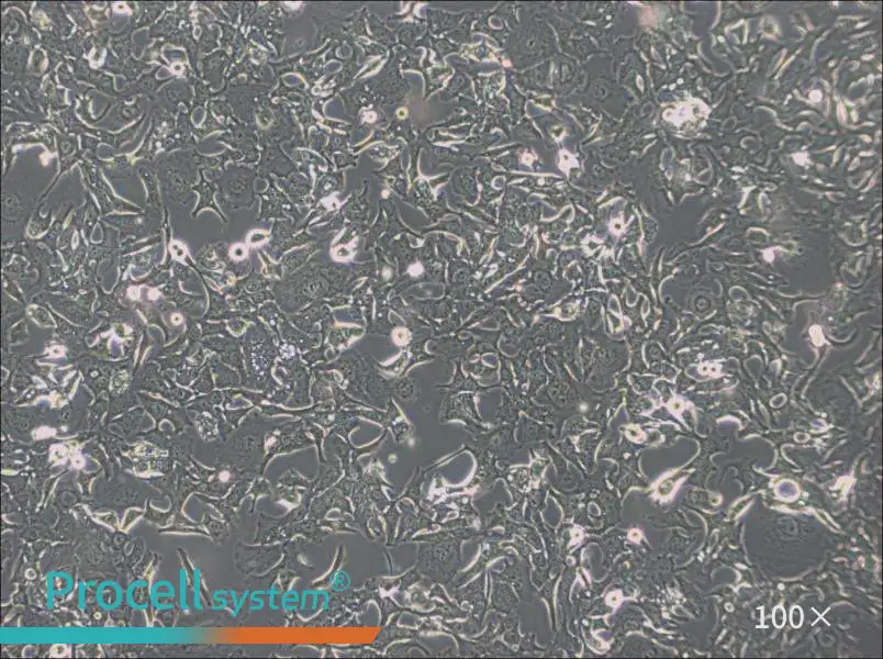 HCC1954 Cell Complete Medium - 1