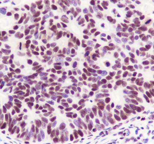 Recombinant SP1 Monoclonal Antibody - 3