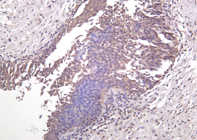 Recombinant MEK-7 Monoclonal Antibody-searchlist-1
