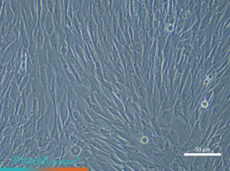 Human Cardiac Fibroblast (Primary cell immortalization) Complete Medium - 5