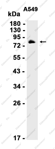 Recombinant FOXO3A Monoclonal Antibody - 1