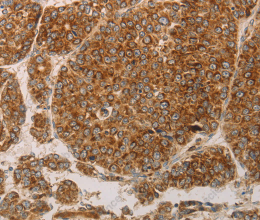 PRDX3 Polyclonal Antibody - 2