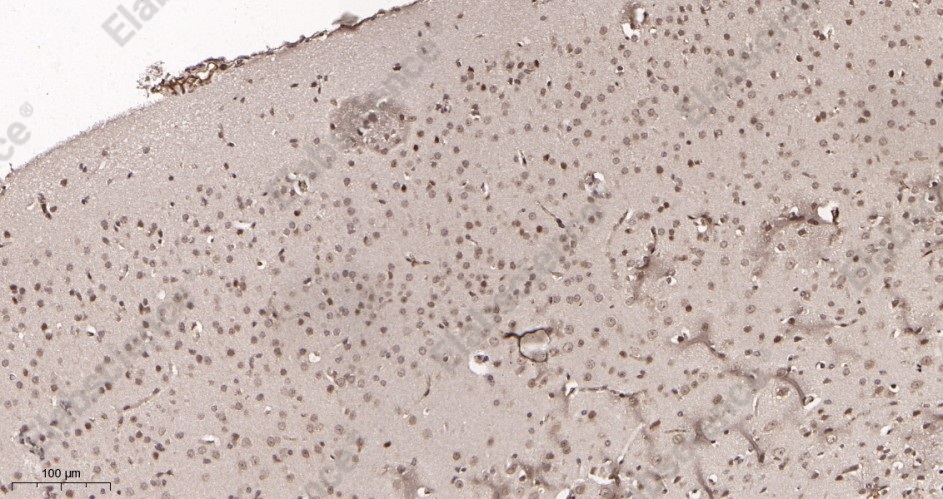 Recombinant p27 KIP 1 Monoclonal Antibody - 3