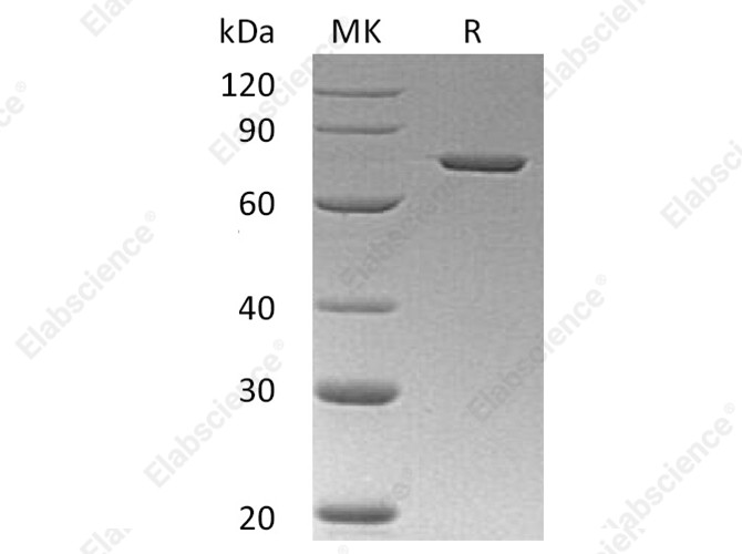 Recombinant Human Annexin A6/ANXA6 Protein (His Tag) - 1