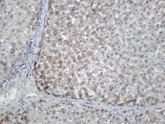 Recombinant RPN1 Monoclonal Antibody - 1
