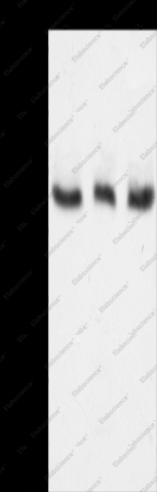 TYR Polyclonal Antibody - 1