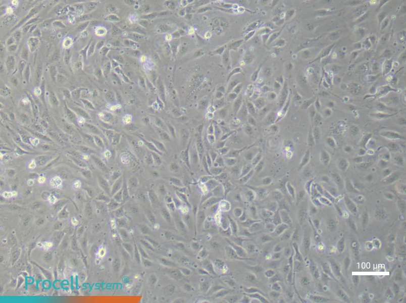 Human Umbilical Vein Endothelial (Primary cell immortalization) Cell Complete Medium - 1
