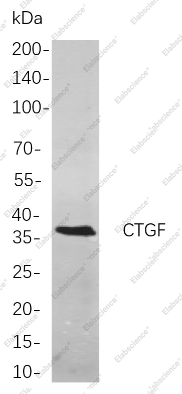 Recombinant CTGF Monoclonal Antibody - 1