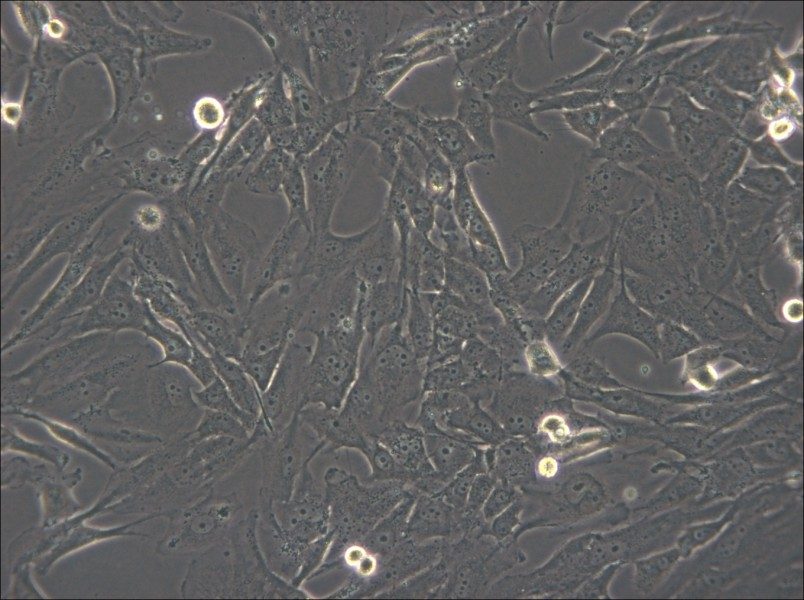 SW1783 (DMEM) Cell Complete Medium - 6