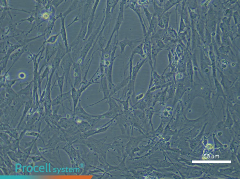 Rat Brain Fibroblast Complete Medium - 4