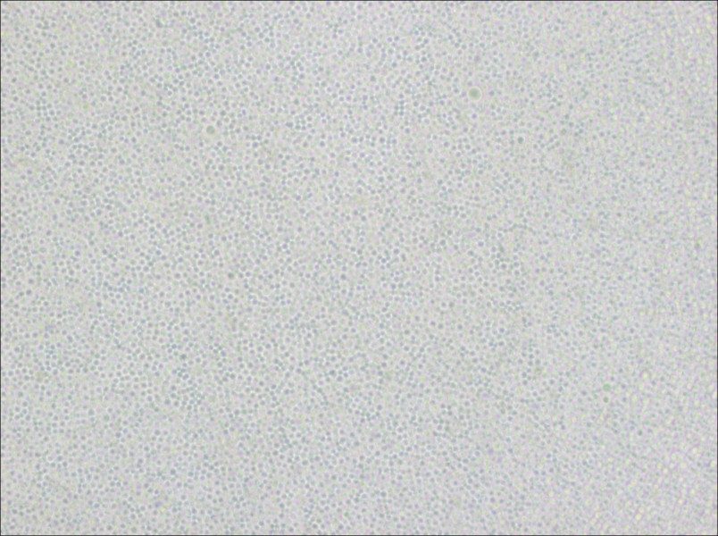 Ramos [RA 1] Cell Complete Medium - small - 3