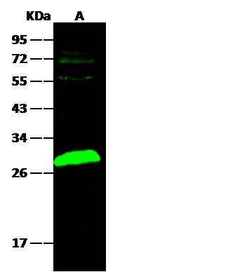 Recombinant UCHL1 Monoclonal Antibody-searchlist-1