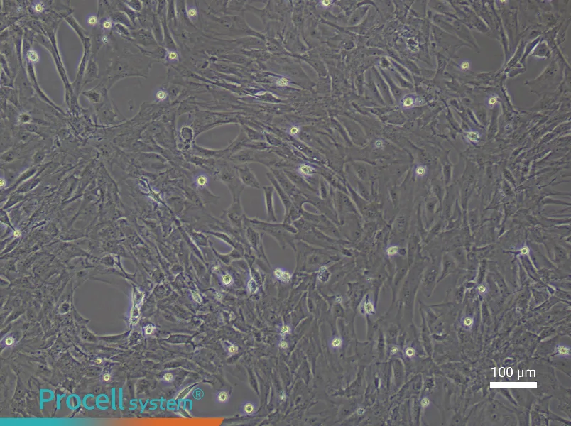 Rat Uterine Fibroblast Complete Medium - 2