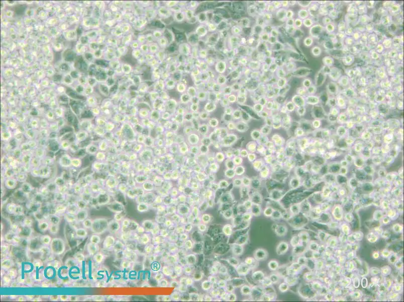 MIA PaCa-2 Cell Complete Medium - small - 4