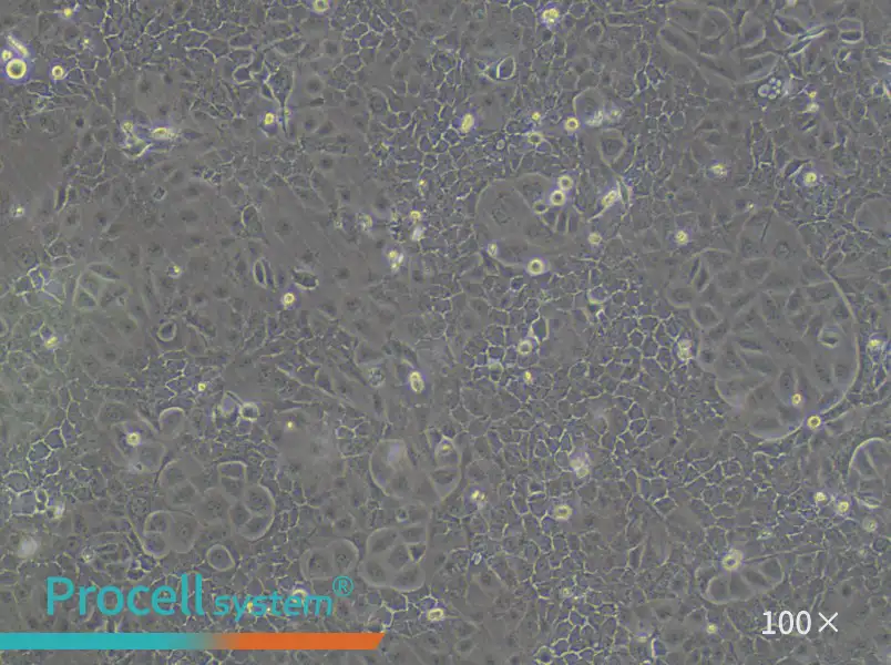 OVCAR-5 Cell Complete MediumOVCAR-5 Cell Complete Medium - 2