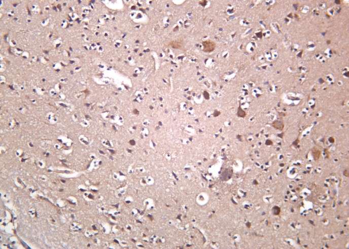 Recombinant OPA1 Monoclonal Antibody-searchlist-1