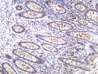 Recombinant NAT10 Monoclonal Antibody - 1