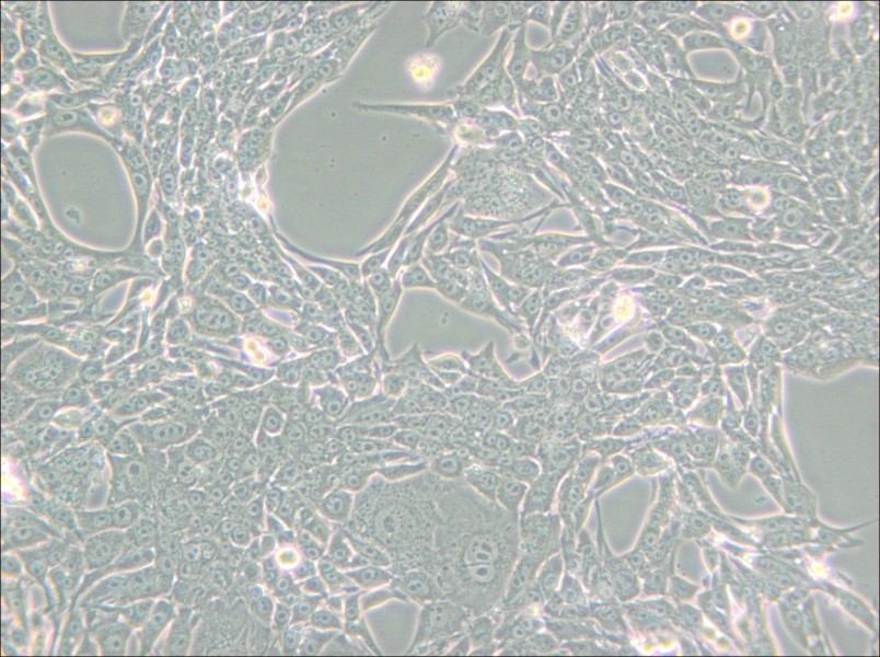 Renca [RenCa] Cell Complete Medium - 5