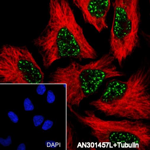 Recombinant CBP Monoclonal Antibody - 2